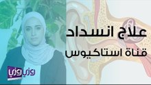 علاج انسداد قناة استاكيوس