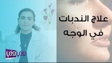علاج الندبات في الوجه