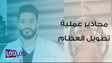 محاذير عملية تطويل العظام