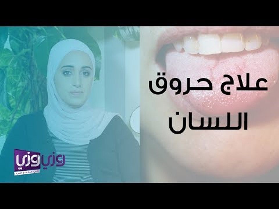 علاج حروق اللسان