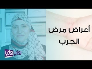 أعراض مرض الجرب وعلاجه