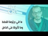 ما هي جرثومة القطط وما تأثيرها على الحامل