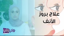 علاج عظمة الأنف البارزة