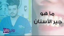 ما هو جير الأسنان