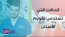 ما هي الحالات التي تستدعي تقويم الأسنان