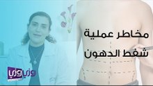 مخاطر عملية شفط الدهون