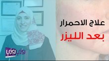 علاج الاحمرار بعد الليزر للوجه