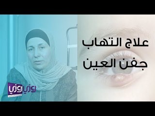 علاج التهاب جفن العين