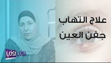 علاج التهاب جفن العين