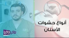 أنواع حشوات الأسنان