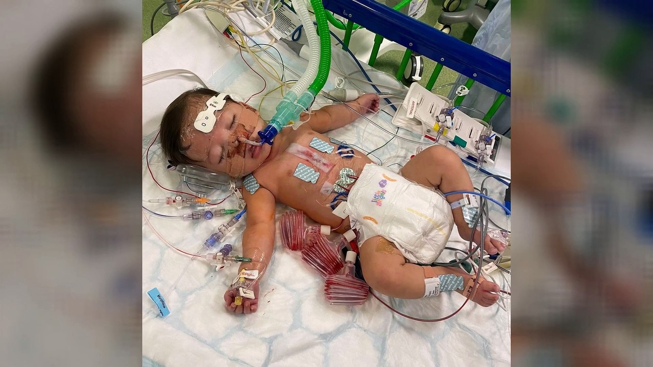 Storm Sanson from Chatham gave birth to premature twins at Evelina London Children's Hospital