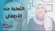 الثعلبة عند الاطفال