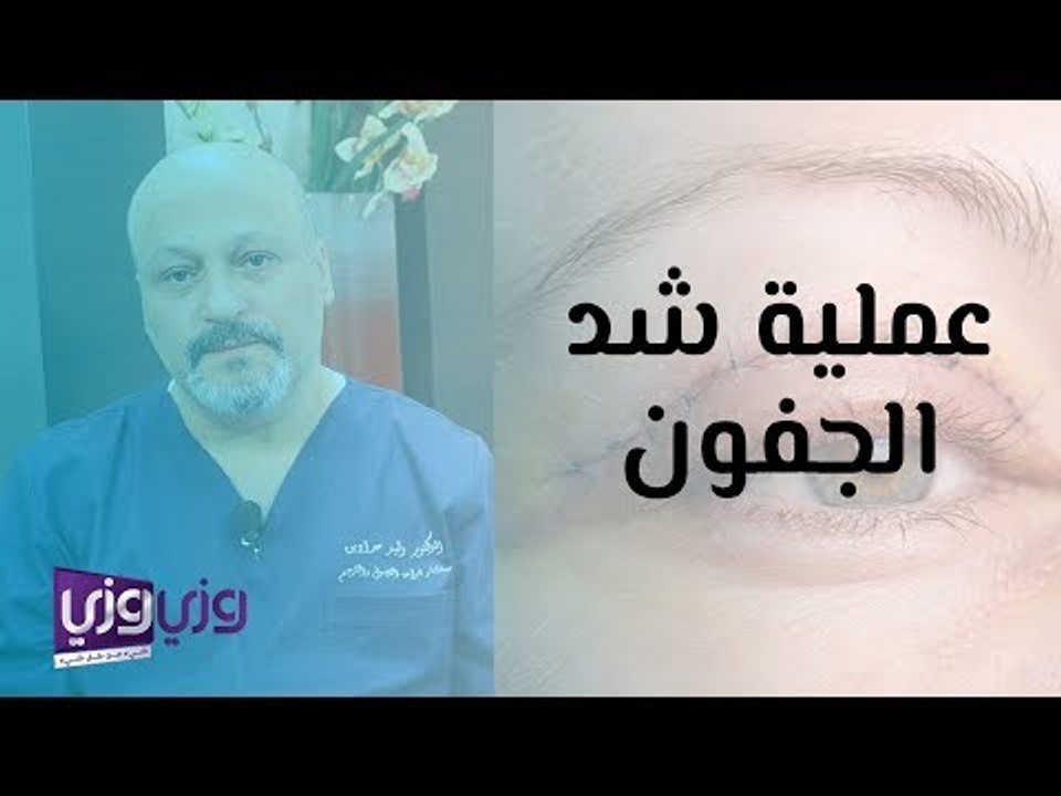 عملية شد الجفون العليا والسفلى ومخاطرها
