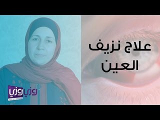 علاج نزيف العين ما بعد الكدمات