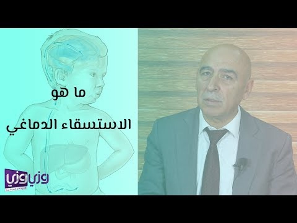 ما هو الاستسقاء الدماغي