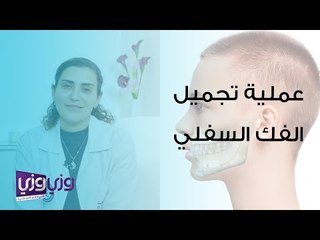 عملية تجميل الفك السفلي