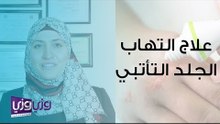 علاج التهاب الجلد التأتبي