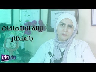 كيفية إزالة الالتصاقات باستخدام المنظار مع الدكتورة أنديرا أبو عناب 👩‍⚕️