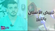 تبييض الأسنان بالليزر