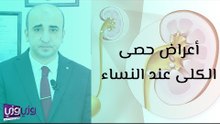 أعراض حصى الكلى عند النساء