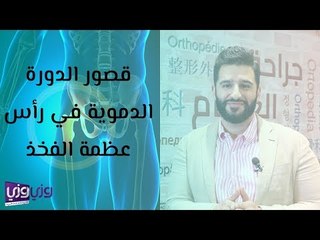 قصور الدورة الدموية في رأس عظمة الفخذ