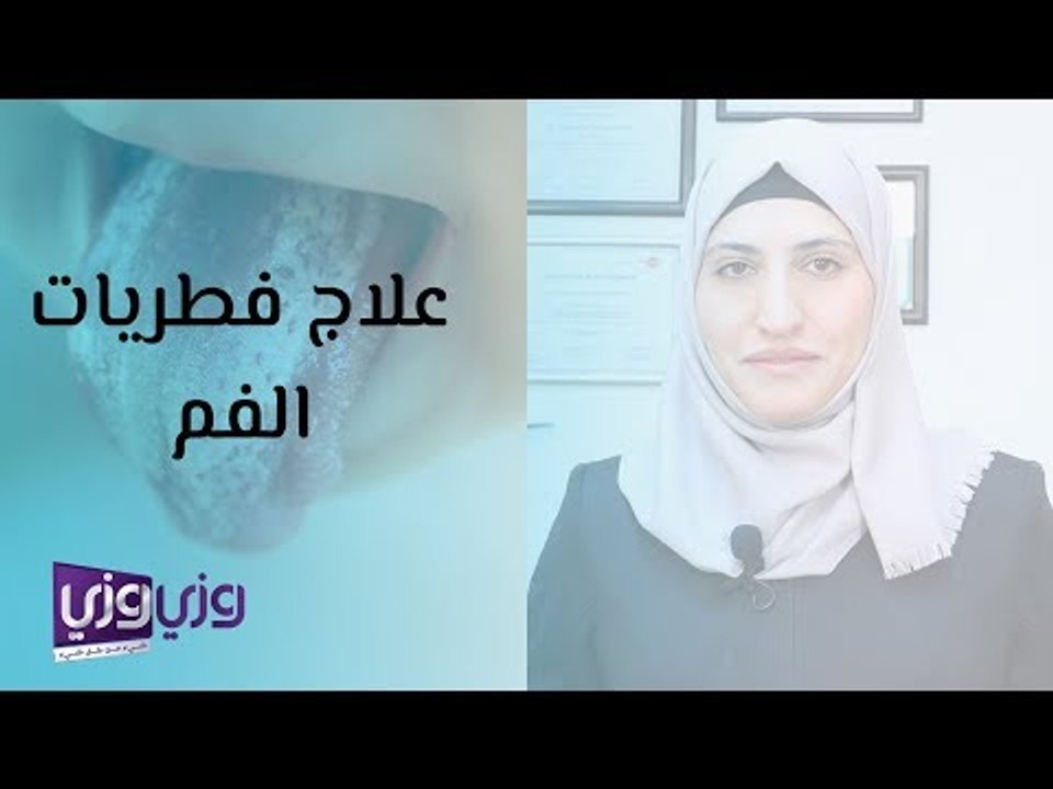 علاج فطريات الفم وأهم أسبابها