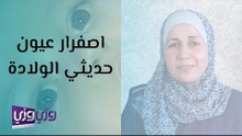 اصفرار العين عند الاطفال حديثي الولادة