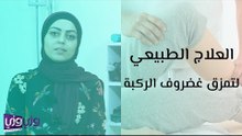 العلاج الطبيعي لتمزق غضروف الركبة