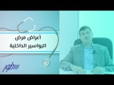 أعراض مرض البواسير الداخلية