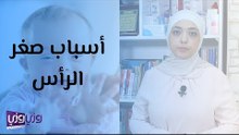 أسباب صغر رأس المواليد وطرق العلاج