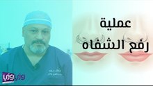 عملية رفع الشفاه