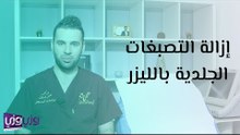 إزالة التصبغات الجلدية بالليزر