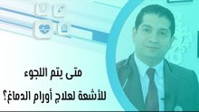 متى يتم اللجوء للأشعة لعلاج أورام الدماغ؟
