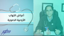 أعراض التهاب الأوعية الدموية
