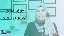 طرق علاج تصبغات الجلد