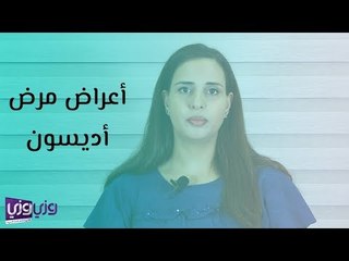 أعراض مرض أديسون وطرق تشخيصه وعلاجه