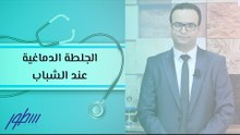 أعراض الجلطة الدماغية عند الشباب