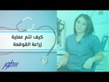 كيف تتم عملية زراعة القوقعة