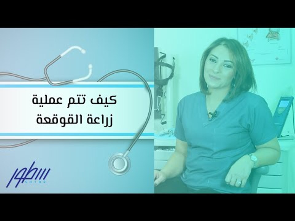 كيف تتم عملية زراعة القوقعة