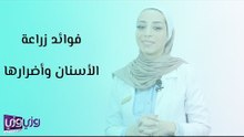 فوائد زراعة الأسنان وأضرارها