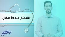 التلعثم عند الأطفال