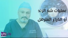 عمليات شد الزند أو الذراع المترهل