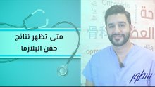 متى تظهر نتائج حقن البلازما