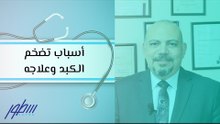 أسباب تضخم الكبد وعلاجه