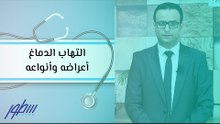التهاب الدماغ أعراضه وأنواعه