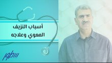 أسباب النزيف المعوي وعلاجه