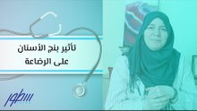 تأثير بنج الأسنان على الرضاعة