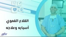 القلاع الفموي أسبابه وعلاجه