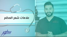 علامات شعر العظم
