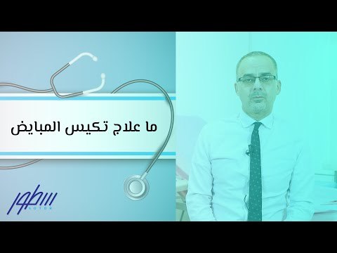 ما علاج تكيس المبايض